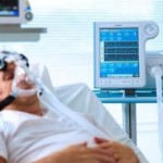 人工呼吸器｜適切な吸引実施のための看護計画と観察項目