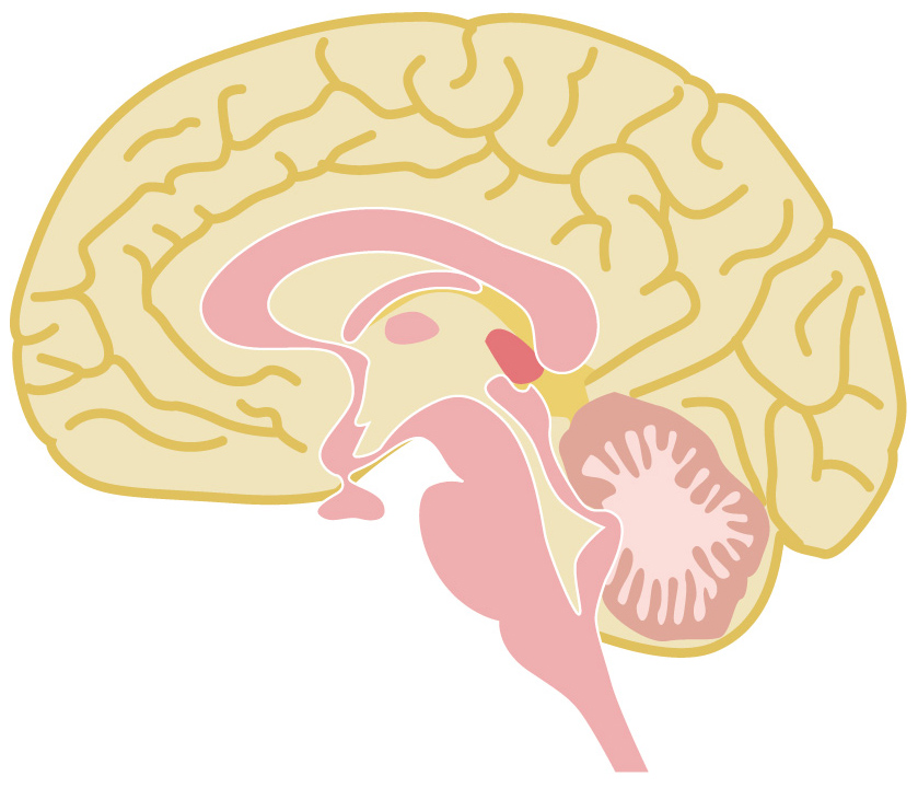 脳出血の急性期 慢性期におけるポイントと看護計画 ナースのヒント