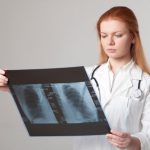 肺がん患者への看護計画（OP・TP・EP）と終末期におけるケア