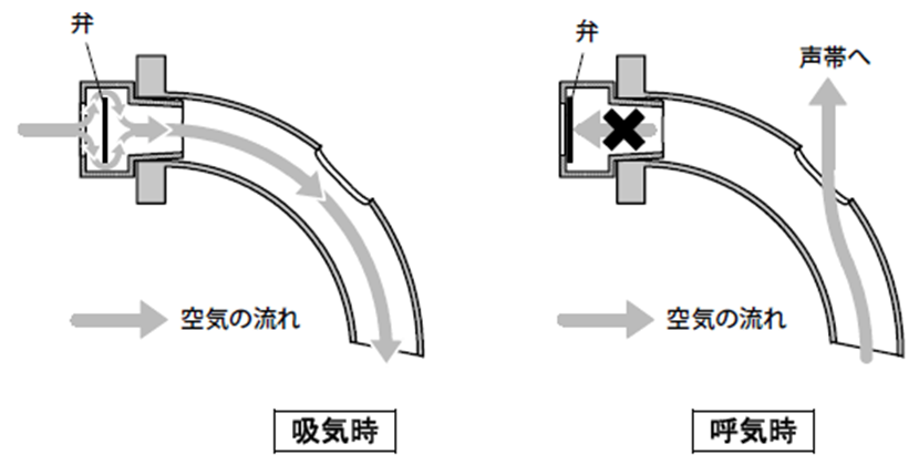 スピーチカニューレの看護 適応や構造 看護計画と管理の注意点 ナースのヒント