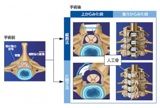 骨 脊椎 臓器 キーホルダー ストラップ グッズ 看護 医療 ハンドメイド