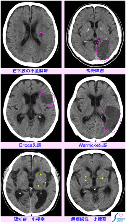高次脳機能障害の看護 障害部位との関連から見る症状と看護計画 研究について ナースのヒント 高次脳機能障害の看護 障害部位との関連から見る症状と看護計画 研究について ナースのヒント