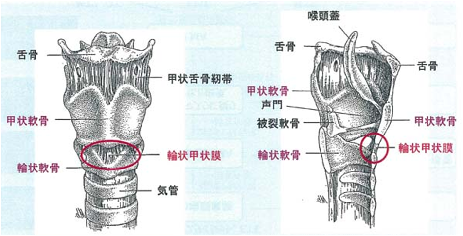 輪状甲状切開術や気管切開術に代わるものはありますか?