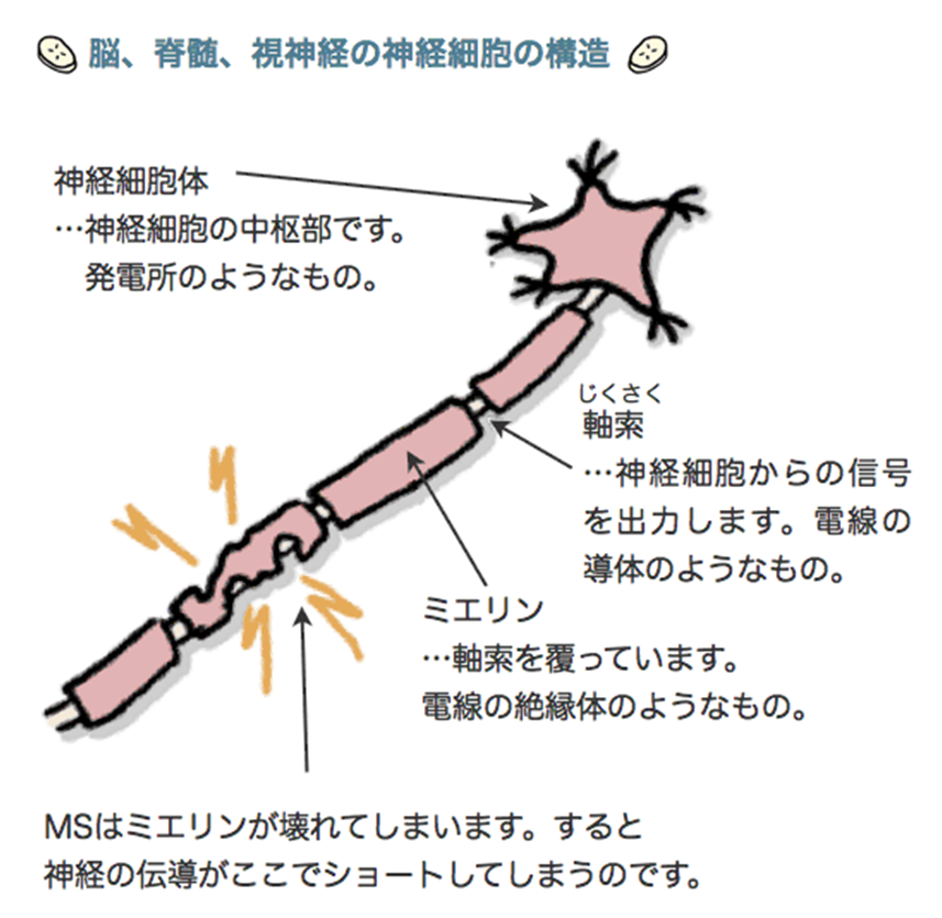 多発 性 硬化 症 ガイドライン Article