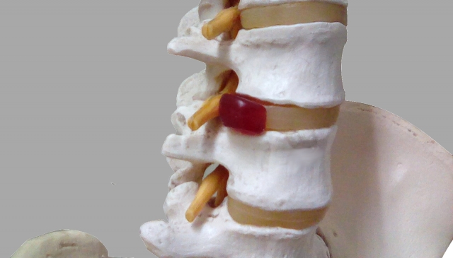 腰部脊椎管狭窄症看護