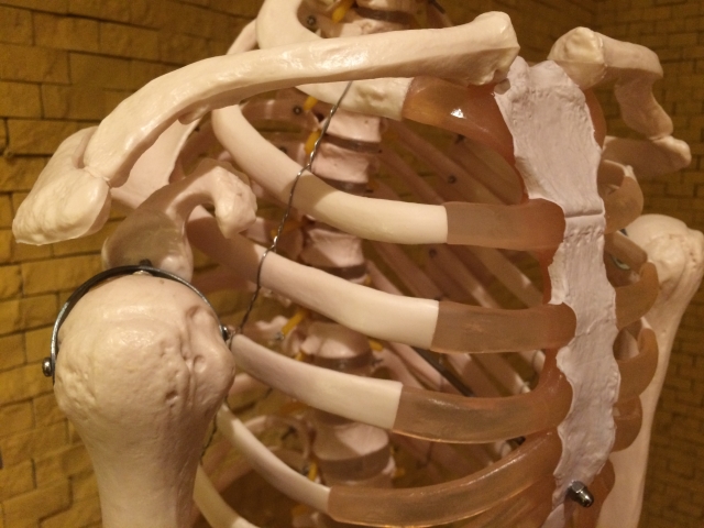 肋骨骨折の看護 基礎知識や原因 治療方法 4つの看護計画 ナースのヒント