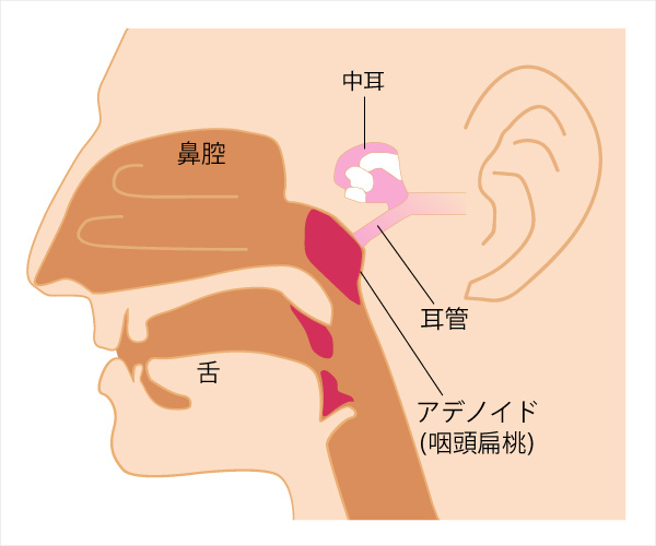 アデノイド顔貌とは 手術などの治療法を小児と大人に分けて解説 ナースのヒント